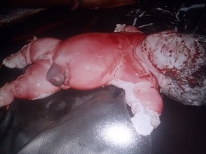 Congenital malform baby which was deliver through Caesarean Section after mother as been in 3 days in Labor